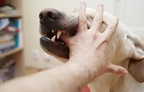 被狗咬就一定会得狂犬病吗