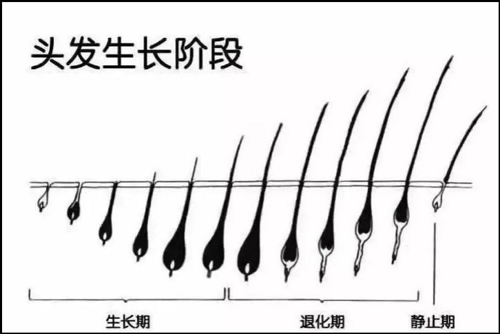 压力大导致脱发的原因找到了